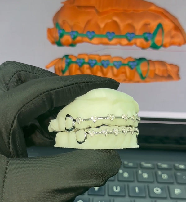 Heart Braces GRILLZ