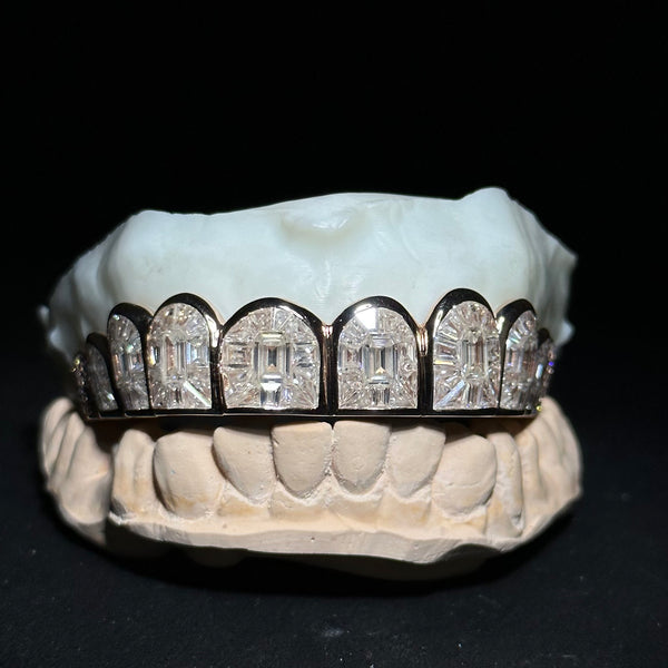 10 on 10 VVS Moissanite Diamond Grillz