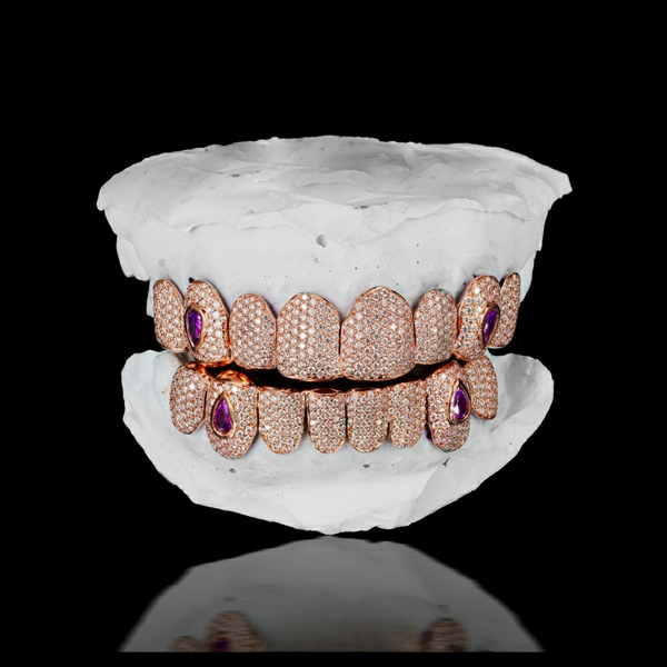 Custom Moissanite Opal 925 Silver Grillz